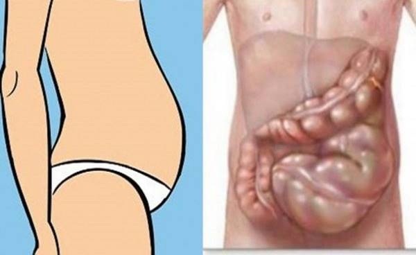 Kövér has zsírégető, hogyan lehet elveszíteni hasa zsír miután egy baba