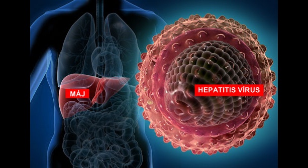WHO FIGYELMEZTETÉS!: Rejtélyes, és súlyos lefolyású hepatitises esetek tucatjai bukkantak fel az Egyesült Államokban és Európában